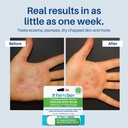 fixmyskin-1-hydrocortisone-healing-body--5.jpg