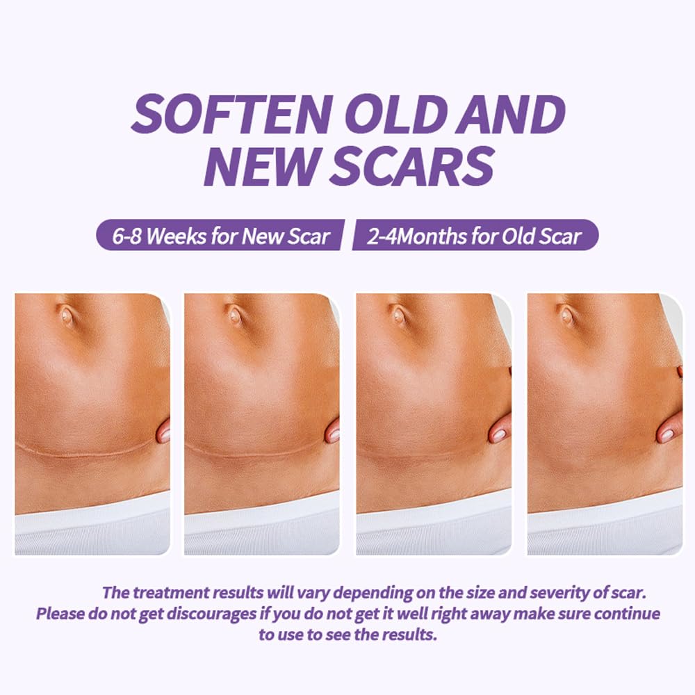 hpufkot-medical-grade-silicone-scar-shee-3.jpg