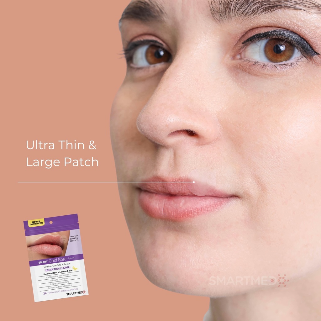 smart-cold-sore-treatment-patch-with-lem-4.jpg