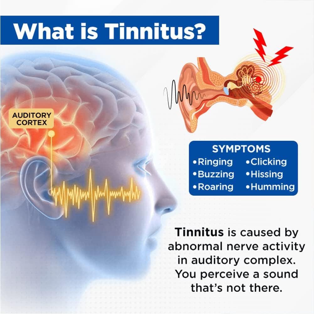 acupeace-tinnitus-relief-device-auricalm-2.jpg