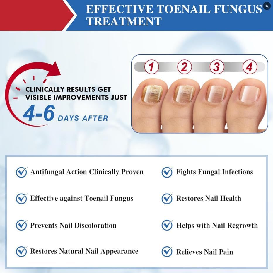 toenail-treatment-extra-strength-upgrade-6.jpg