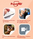patchmd-nausea-relief-patch-30-day-suppl-2.jpg