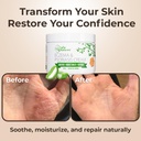 wild-naturals-eczema-psoriasis-cream-for-5.jpg
