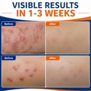 johai-human-itch-relief-cream-pleasant-s-71oJmIlUMgL.jpg