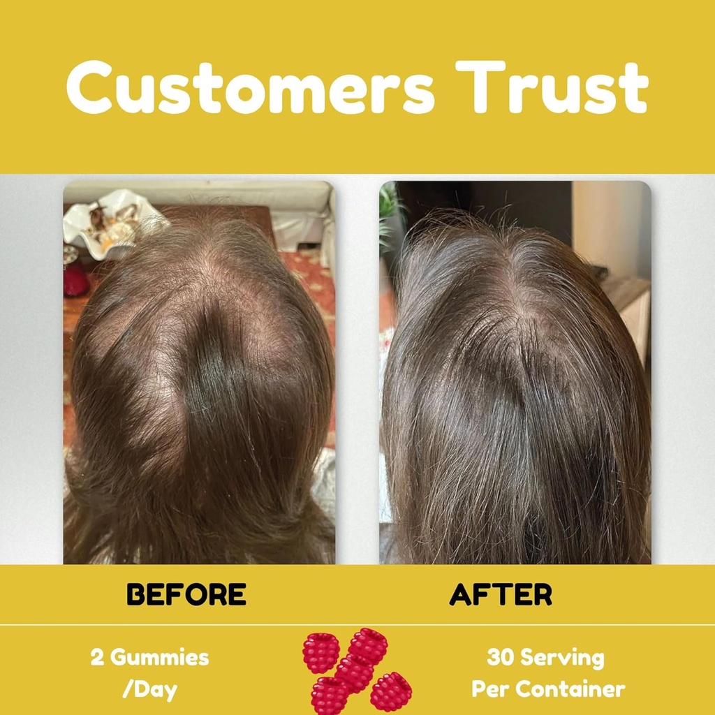 premium-hair-skin-and-nails-gummies-5000-2.jpg