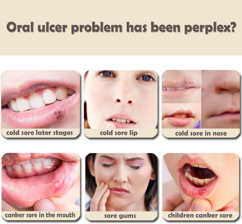 reusable-canker-sore-treatment-device-re-5.jpg