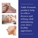 noble-formula-1-hydrocortisone-cream-wit-5.jpg