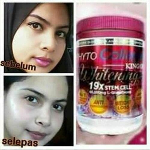 Phyto Collagen Whitening 19X STEM CELL Anti-Aging Pro Whitening Results Energy 4
