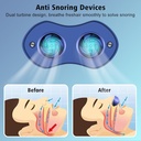 mini-anti-snoring-devices-for-snoring-ef-5.jpg