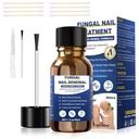Zdravljenje glivice na nohtih, glivice na glavici zdravljenje dodatno moč, Fungus zdravljenje nohtov, toe nail glivice zdravljenja za glivice nail rumeno noht zdravljenje(1fl oz/30ml)