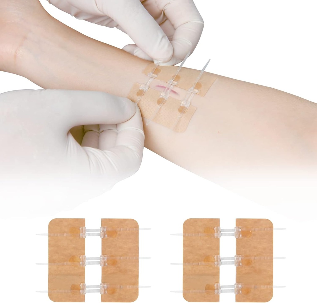 Zip Stitch Laceracija Popravila brez Stitches Butterfly Bandaids Hitri Klot - Nujna zapora ran Naprava 2 kosov(PU)