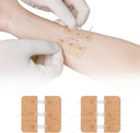 Zip Stitch Laceracija Popravila brez Stitches Butterfly Bandaids Hitri Klot - Nujna zapora ran Naprava 2 kosov(PU)