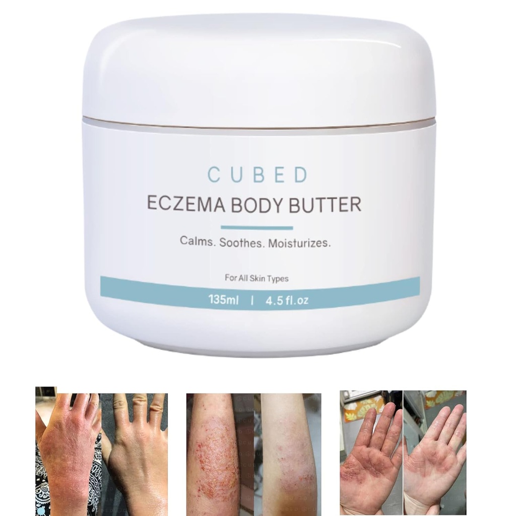 Cubed 4,5 oz Eccema krema za odrasle, Eccema Relief, Eccema Zdravljenje, Vlažilna suha namakana koža, Pametna losjon za topične simptome odtegnitve steroidov, Psoriaza in Rosacea, Eczema, Dermatitis