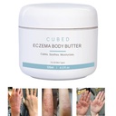Cubed 4,5 oz Eccema krema za odrasle, Eccema Relief, Eccema Zdravljenje, Vlažilna suha namakana koža, Pametna losjon za topične simptome odtegnitve steroidov, Psoriaza in Rosacea, Eczema, Dermatitis