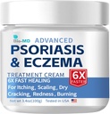 Biološka-MD Psoriaza Eccema Cream, Eccema Cream za odrasle, Dodatna kontrola moči ponovitev, Olajšajte Symptoma odpornosti, Učinkovito za seboroični dermatitis, Folikulitis Zdravljenje