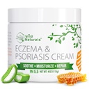 Wild Naturals Eccema & Psoriaza Krema za suho, srbečo kožo – Eccema Relief za odrasle in otroke – Vlažilni Psoriaza Cream z Manuka med