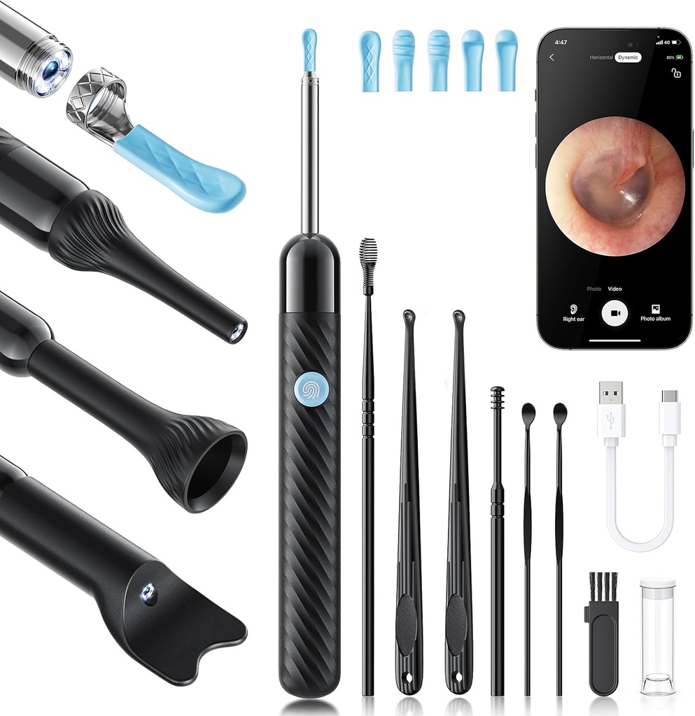 Loyker X6 Ear Wax Odstranjevalno orodje Kamera, Čistilec ušes s kamero, FSA - HSA trgovina upravičen, 1080P Ear Camera s 6LED svetlobo za uho/Nose/Throat/Tonsil kamen pregled, črna