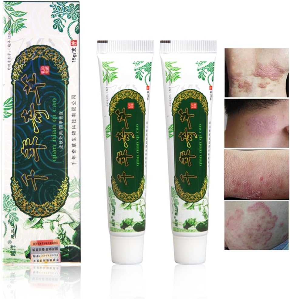 Oversea Tisočletna zeliščna krema kitajski zeliščni ekcem, psoriaza kreme dermatitis in ekcema pruritus psoriaza JIULIN olje (2PCS)