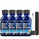 4Pcs zdravljenje glivic na nohtih, 25% undecilenska kislina, zdravljenje gliv na nohtih, zdravljenje glivic na nohtih (2 FL OZ)